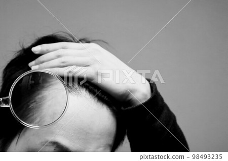 A man who is troubled with thinning hair 98493235