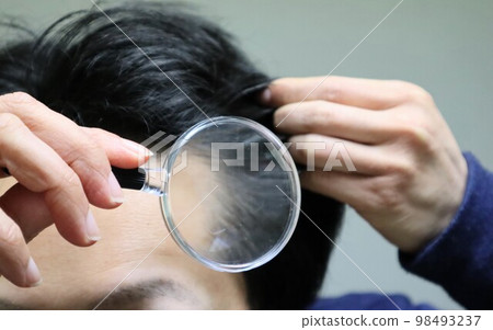 Japanese men suffering from thinning hair Japanese men suffering from thinning hair 98493237