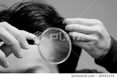 person suffering from thinning hair 98493238