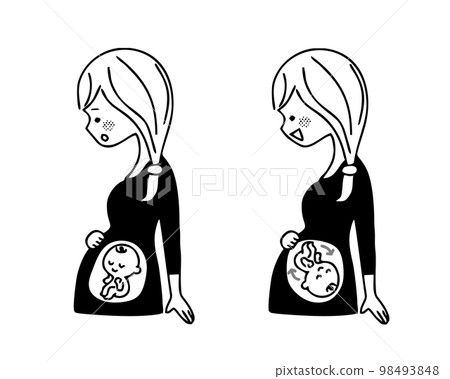 孕婦臀位單色 98493848