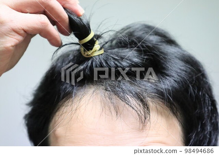 頭髮稀疏的男人紮頭發 頭髮稀疏的男人紮頭發 98494686