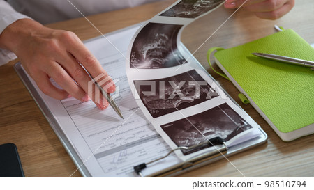 Female doctor analyzes results of patient's medical examination at her desk in clinic. Female doctor analyzes results of patient's medical examination at her desk in clinic. 98510794
