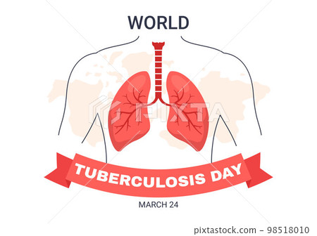 World Tuberculosis Day on March 24 Illustration with Pictures of the Lungs and Organ Inspection in Flat Cartoon Hand Drawn Landing Page Templates World Tuberculosis Day on March 24 Illustration with Pictures of the Lungs and Organ Inspection in Flat Cartoon Hand Drawn Landing Page Templates 98518010