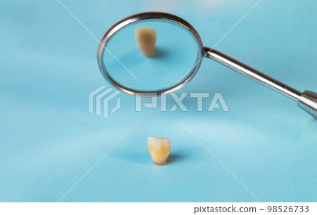 dental mirror and milk baby tooth on a blue background. The concept of pediatric dental surgery. Close-up 98526733