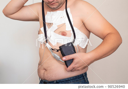 Cardiological procedure for the study of the heart Holter monitoring. Identification of heart diseases, blood supply and disorders of the heart, heart failure. Cardiological procedure for the study of the heart Holter monitoring. Identification of heart diseases, blood supply and disorders of the heart, heart failure. 98526940