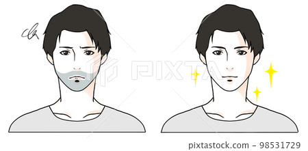 Before-after illustration of a man suffering from dark beard 98531729