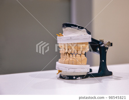 Manufacturing of a human permanent ceramic-metal dental prosthesis on implants Manufacturing of a human permanent ceramic-metal dental prosthesis on implants 98545821