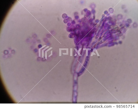 用光學顯微鏡放大的分生孢子 用光學顯微鏡放大的分生孢子 98565714