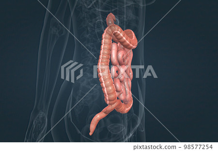 The small bowel connects to the large bowel, also called the large intestine or colon. The small bowel connects to the large bowel, also called the large intestine or colon. 98577254