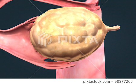 The ovaries are small, oval-shaped glands located on either side of your uterus. The ovaries are small, oval-shaped glands located on either side of your uterus. 98577263