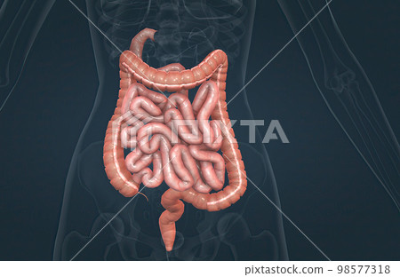 The small bowel connects to the large bowel, also called the large intestine or colon. The small bowel connects to the large bowel, also called the large intestine or colon. 98577318