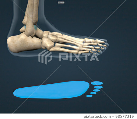 Flat feet is a common condition in which the arches on the inside of the feet flatten when pressure is applied to them. 98577319