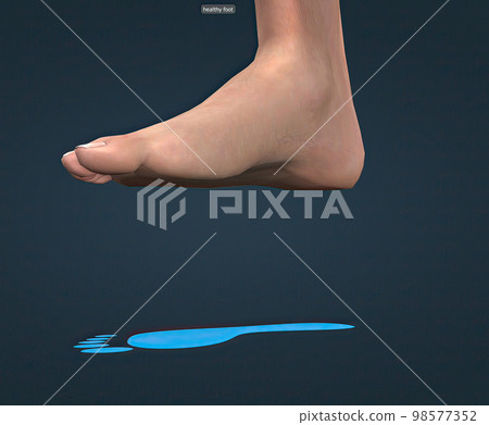 Healthy foot and blue footprint Healthy foot and blue footprint 98577352