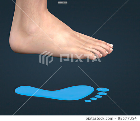 Healthy foot and blue footprint Healthy foot and blue footprint 98577354
