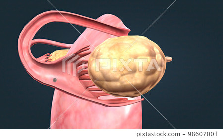 The ovaries are small, oval-shaped glands located on either side of your uterus. 98607001