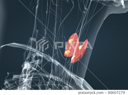 The thyroid gland is an endocrine gland found in the neck in humans and consists of two interconnected lobes. The thyroid gland is an endocrine gland found in the neck in humans and consists of two interconnected lobes. 98607279