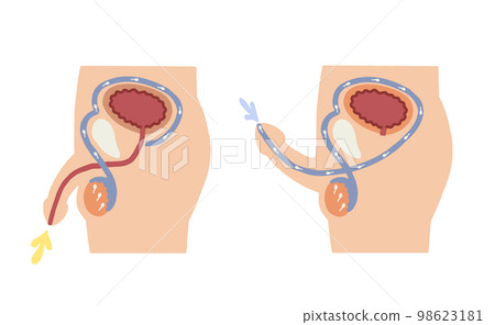 Male reproductive system ejaculation mechanism vector illustration 98623181