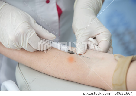 Close-up hand of a nurse, doctor or medical technologist in medical gloves takes a blood sample from a patient in a hospital. Close-up hand of a nurse, doctor or medical technologist in medical gloves takes a blood sample from a patient in a hospital. 98631664