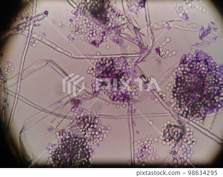 黑曲霉的大孢子 黑曲霉的大孢子 98634295