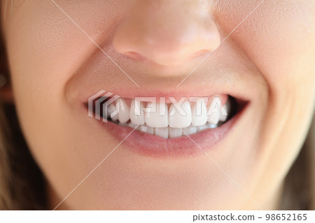 Close-up of female showing healthy smooth white teeth. Close-up of female showing healthy smooth white teeth. 98652165