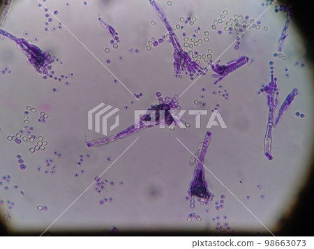 Mold growing around camembert cheese Mold growing around camembert cheese 98663073