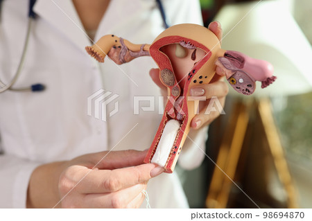 Female gynecologist demonstrating model of female reproductive system and hygienic tampon. 98694870