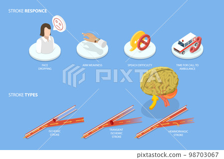 3D Isometric Flat Vector Conceptual Illustration of Brain Blood Supply Problem 3D Isometric Flat Vector Conceptual Illustration of Brain Blood Supply Problem 98703067