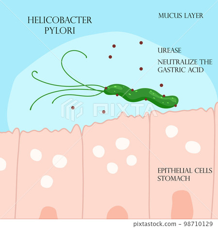 Helicobacter pylori in mucosal layer in stomach infographic 98710129