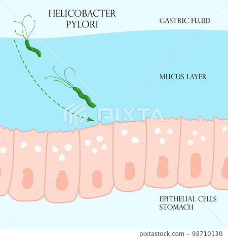 Helicobacter pylori in mucosal layer in stomach illustration 98710130