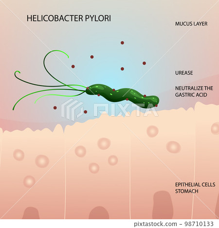 Helicobacter pylori on epithelial cells in human stomach illustration 98710133