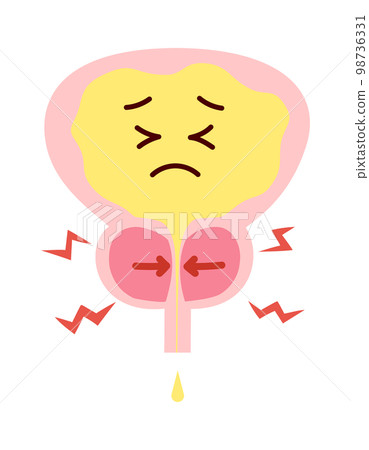 Illustration of a painful bladder with an enlarged prostate 98736331