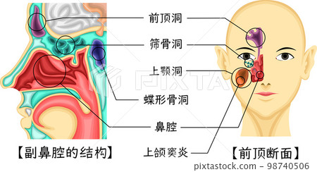 竇結構圖中文 竇結構圖中文 98740506