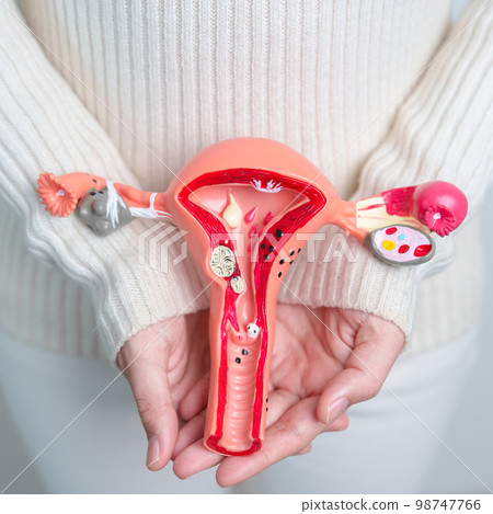 Woman holding Uterus and Ovaries model. Ovarian and Cervical cancer, Cervix disorder, Endometriosis, Hysterectomy, Uterine fibroids, Reproductive system and Pregnancy concept 98747766
