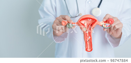 Doctor holding Uterus and Ovaries model. Ovarian and Cervical cancer, Cervix disorder, Endometriosis, Hysterectomy, Uterine fibroids, Reproductive system and Pregnancy concept 98747884