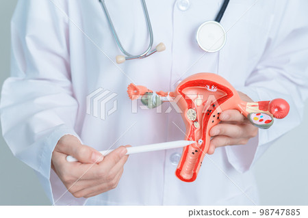 Doctor holding Uterus and Ovaries model. Ovarian and Cervical cancer, Cervix disorder, Endometriosis, Hysterectomy, Uterine fibroids, Reproductive system and Pregnancy concept 98747885