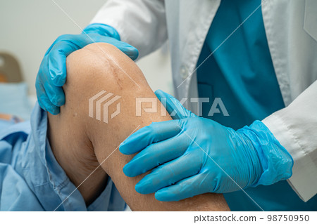 Asian senior or elderly old lady woman patient show her scars surgical total knee joint replacement Suture wound surgery arthroplasty on bed in nursing hospital ward, healthy strong medical concept. 98750950
