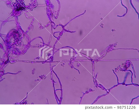 Black mold growing on refrigerator packing 98751226