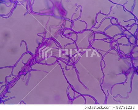Black mold growing on refrigerator packing Black mold growing on refrigerator packing 98751228