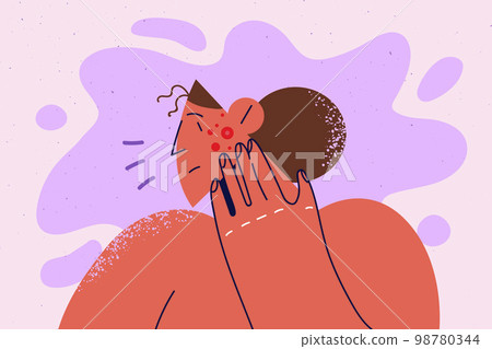Unhappy woman distressed with pimples on face Unhappy woman distressed with pimples on face 98780344