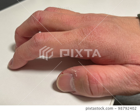 皮膚粗糙的男士手 98792402