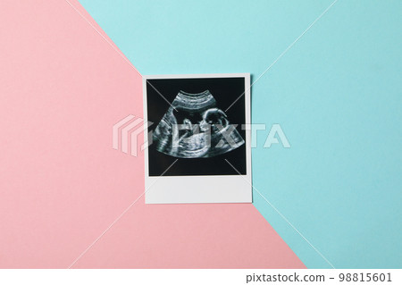 Concept of maternity, parenting and pregnancy, top view 98815601