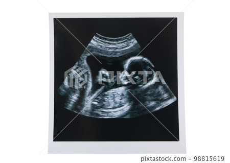 Concept of maternity, parenting, happy pregnancy period Concept of maternity, parenting, happy pregnancy period 98815619
