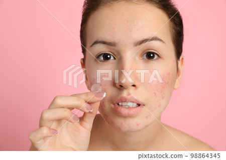 Teen girl applying acne healing patch on light pink background Teen girl applying acne healing patch on light pink background 98864345