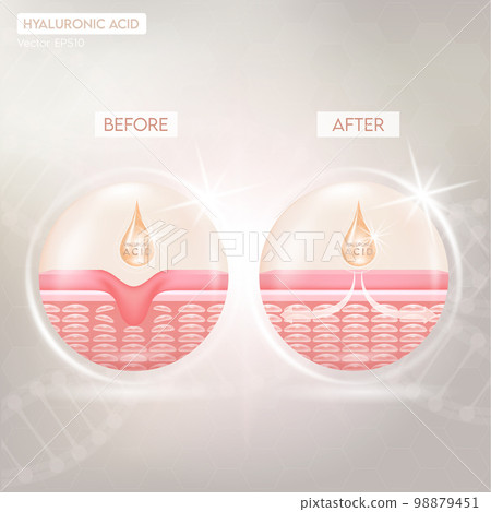 Process of getting skin younger with help of hyaluronic acid before and after skin solutions collagen serum drop with cosmetic advertising background. Vector EPS10 Process of getting skin younger with help of hyaluronic acid before and after skin solutions collagen serum drop with cosmetic advertising background. Vector EPS10 98879451