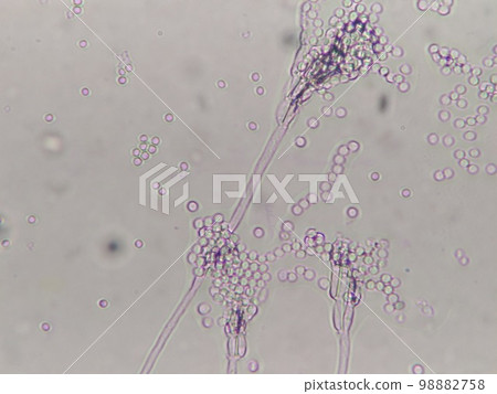 Microscopic photo of mold on camembert cheese Microscopic photo of mold on camembert cheese 98882758