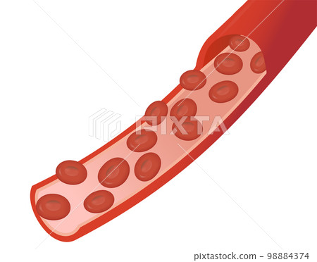 Illustration of the image of red blood cells flowing through blood vessels (with blood vessels) - the background is transparent. Illustration of the image of red blood cells flowing through blood vessels (with blood vessels) - the background is transparent. 98884374