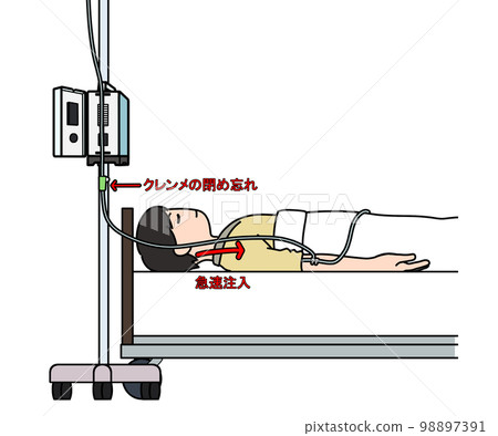 Free flow phenomenon of infusion pump 98897391