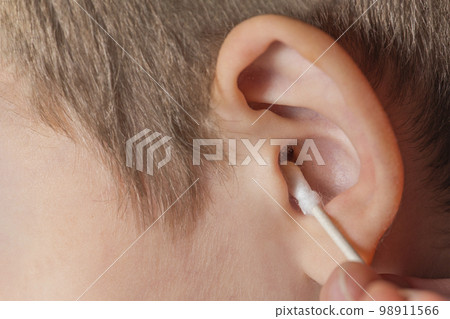 Cleaning the ear with a cotton swab. The process of cleaning the ears close-up, yellow cotton swab with dirt from the ear. Mother cleaning baby's ear, with copy space 98911566