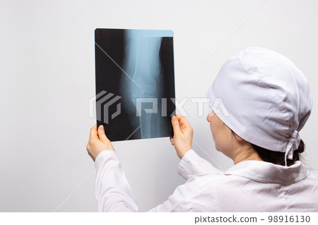 A doctor or radiologist holds an X-ray of a person's leg - knee, knee injury. Diagnosis of fractures or bone fractures A doctor or radiologist holds an X-ray of a person's leg - knee, knee injury. Diagnosis of fractures or bone fractures 98916130
