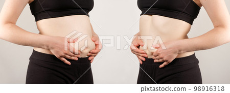 A woman shows belly fat before and after losing weight. Comparison before and after, the concept of excess weight A woman shows belly fat before and after losing weight. Comparison before and after, the concept of excess weight 98916318
